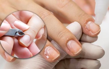 Топ средств для удаления кутикулы и натоптышей